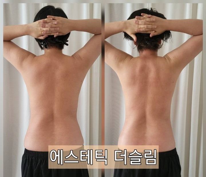 에스테틱 더슬림 picture 1