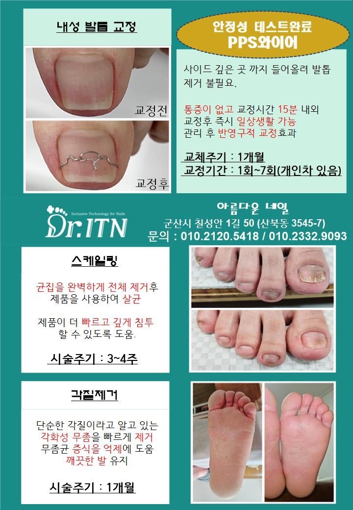 파고드는 발톱에 탁월한 와이어 사용