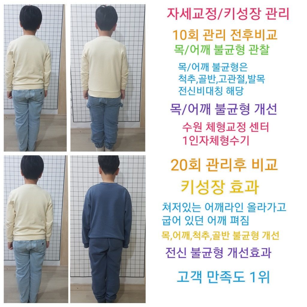 자녀 키성장/ 자세교정 관리 방학 이벤트