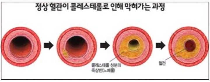 혈관, 근육, 피부까지? 40분 투자로 모두 지키자