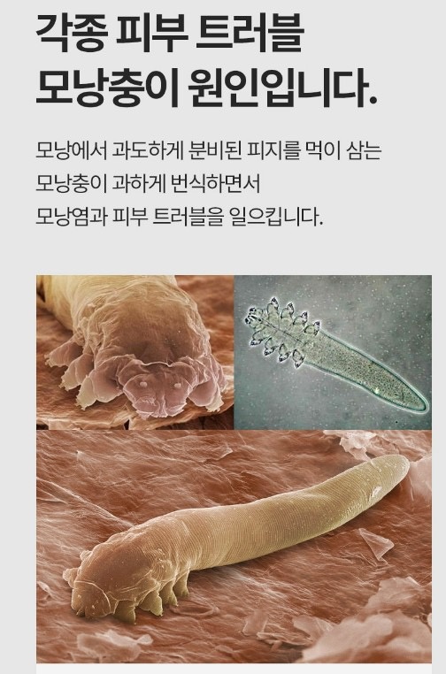 구서동피부모공관리 picture 9