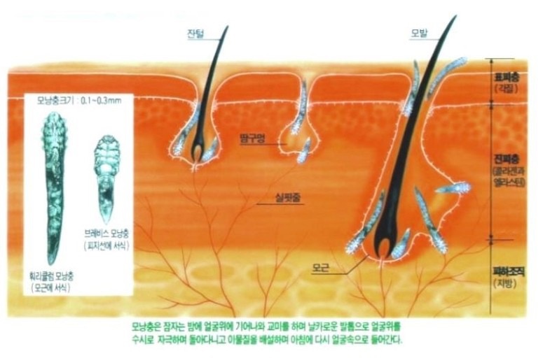 구서동피부모공관리 picture 8