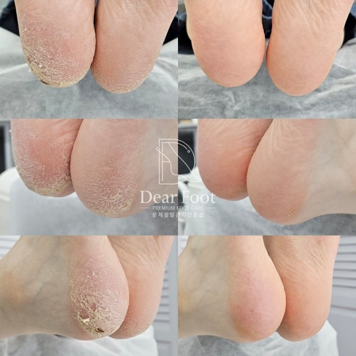 디어풋 picture 8