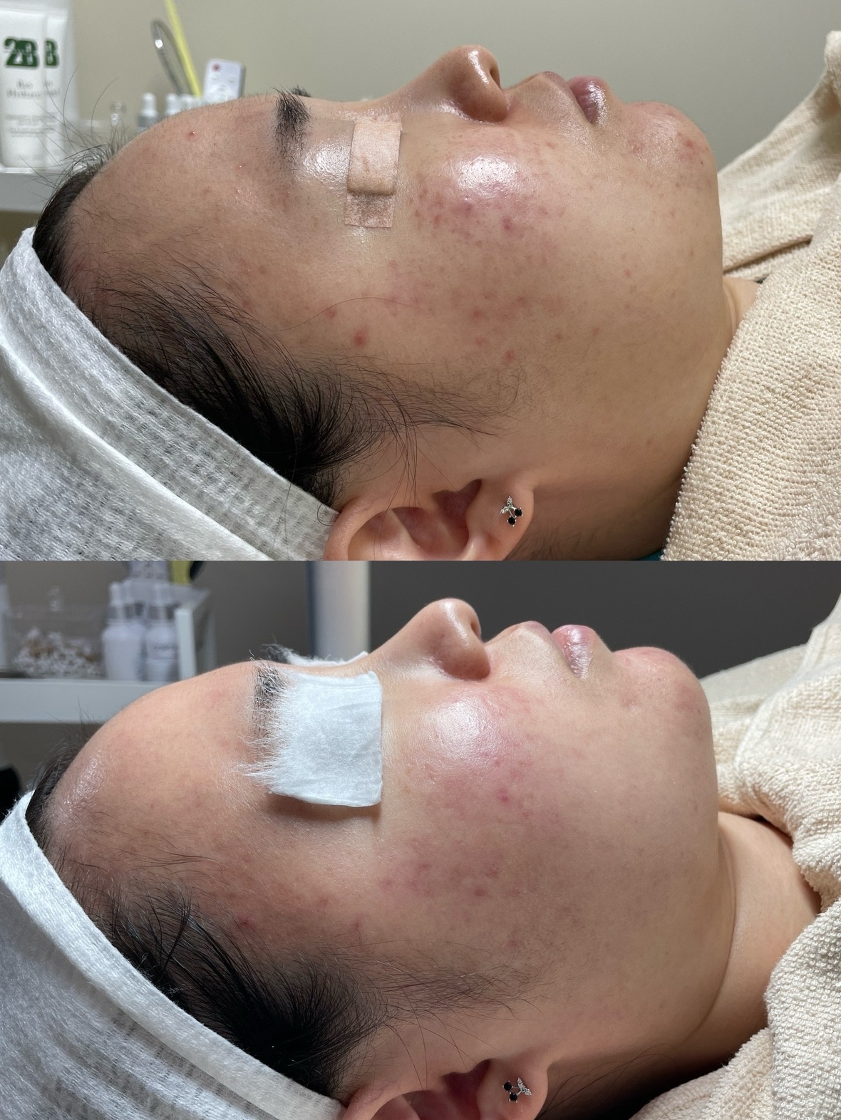 윤에스테틱 picture 7