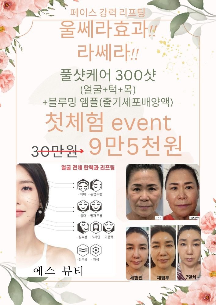 페이스 강력 리프팅!! 라쎄라♡《첫체험 9만5천원》합리적인 가격으로 경험해보세요^^ 