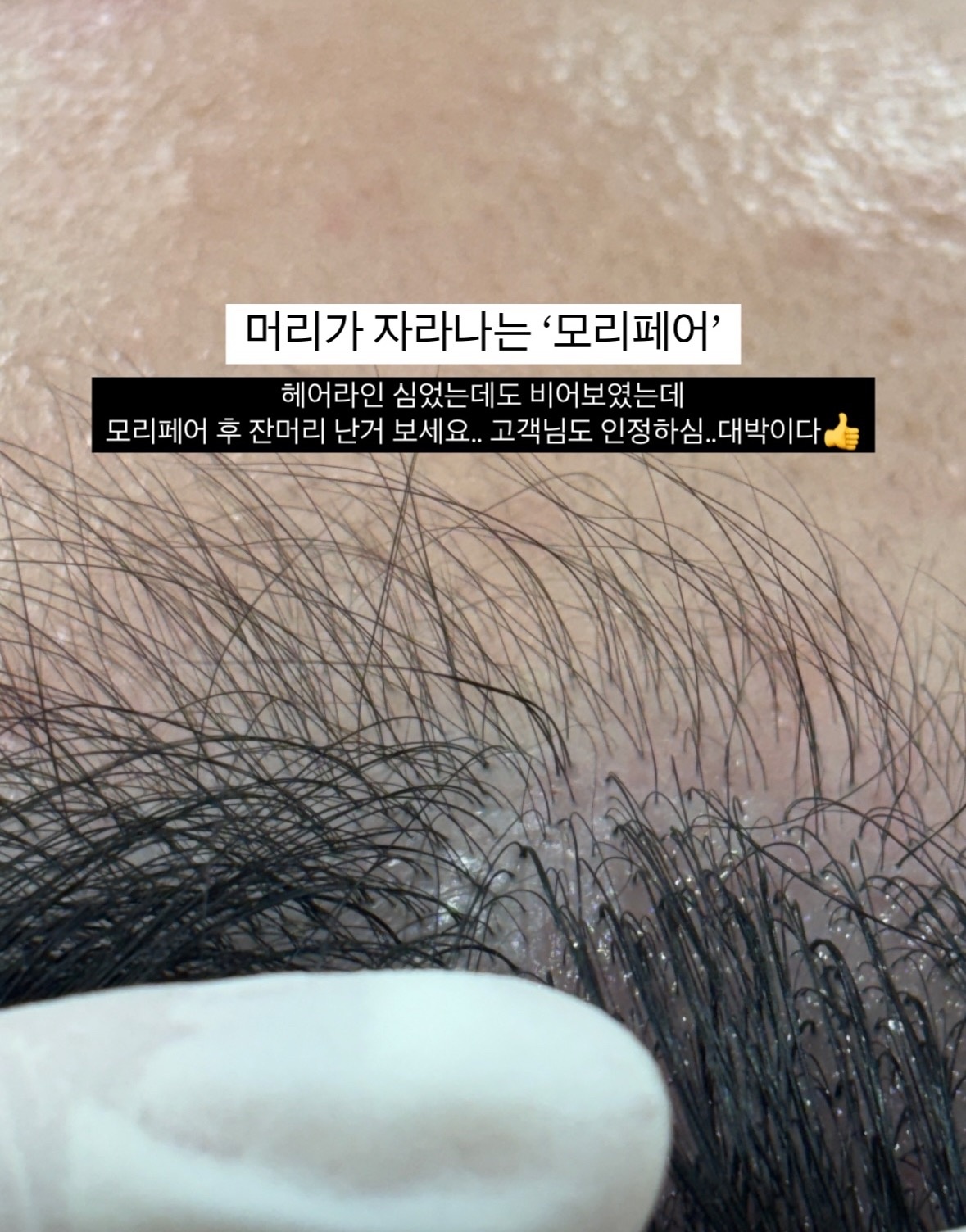 에르에스테틱 picture 2