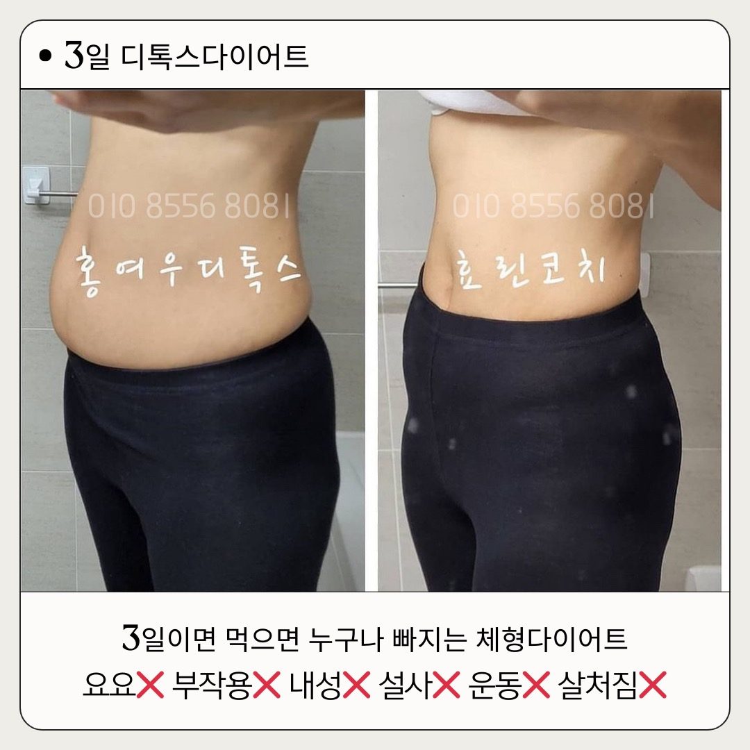 3일디톡스 전후 뱃살비교해보세요!