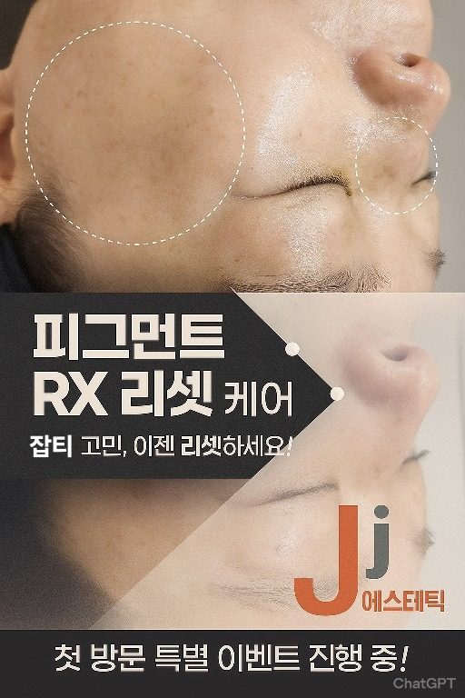 이 케어받고 달라졌어요~비밀은 '피그먼트 RX 리셋'