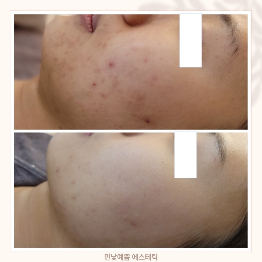 민낯예쁨 picture 7
