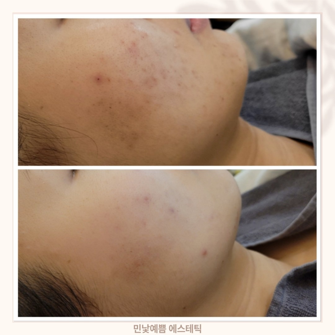 민낯예쁨 picture 8