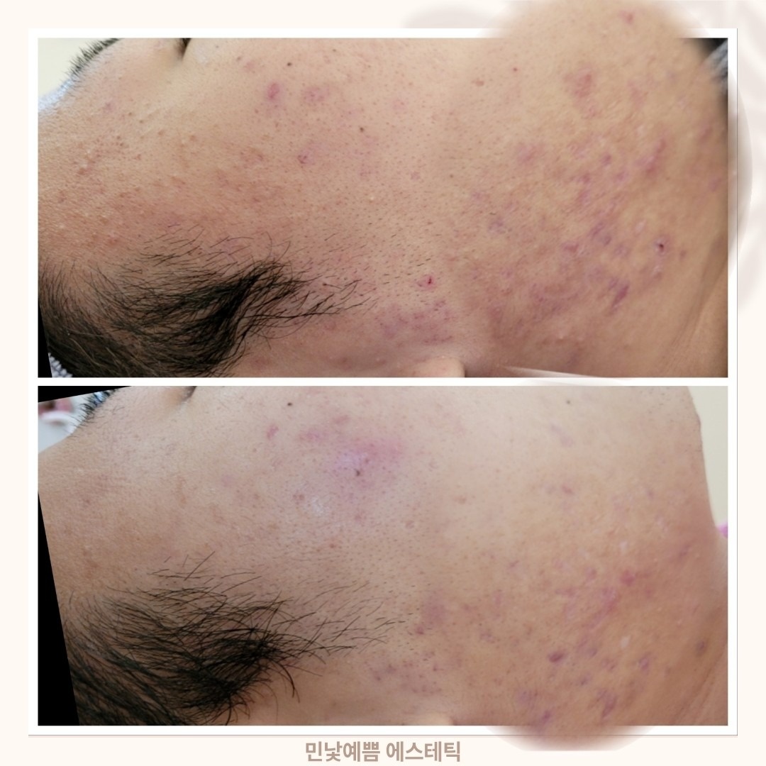 민낯예쁨 picture 2