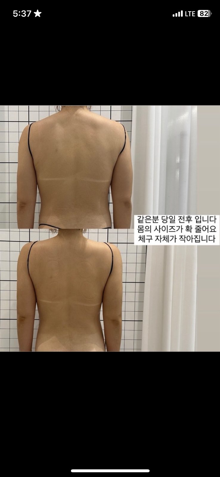 1회만에 내 몸에 지방과 이별하는 셀핏케어