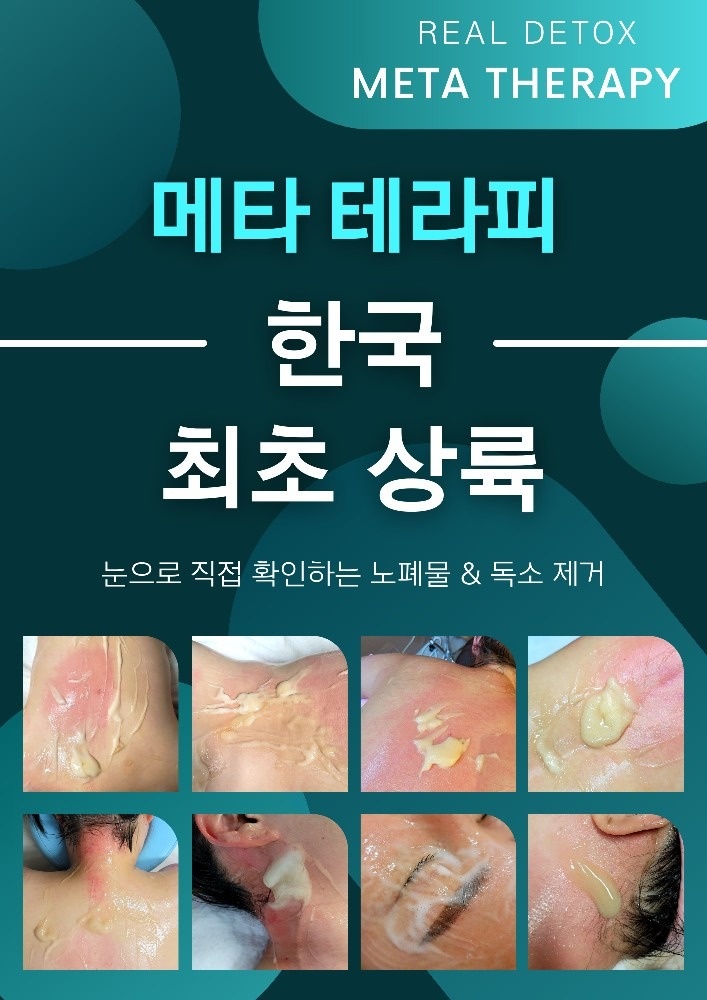 메타 테라피 picture 2