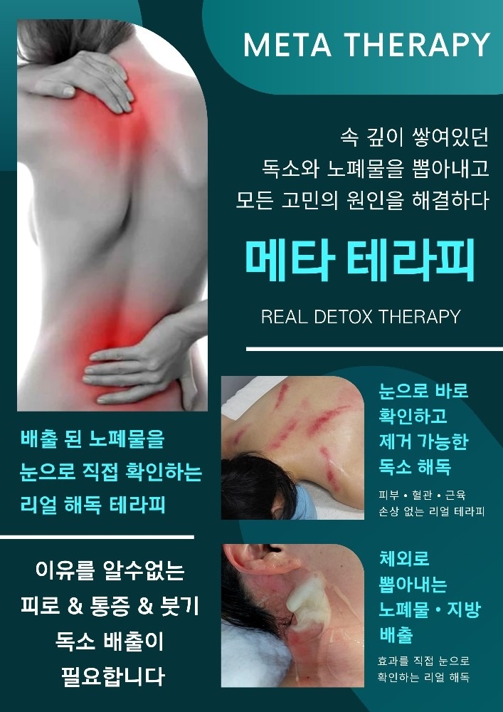 메타 테라피 picture 1