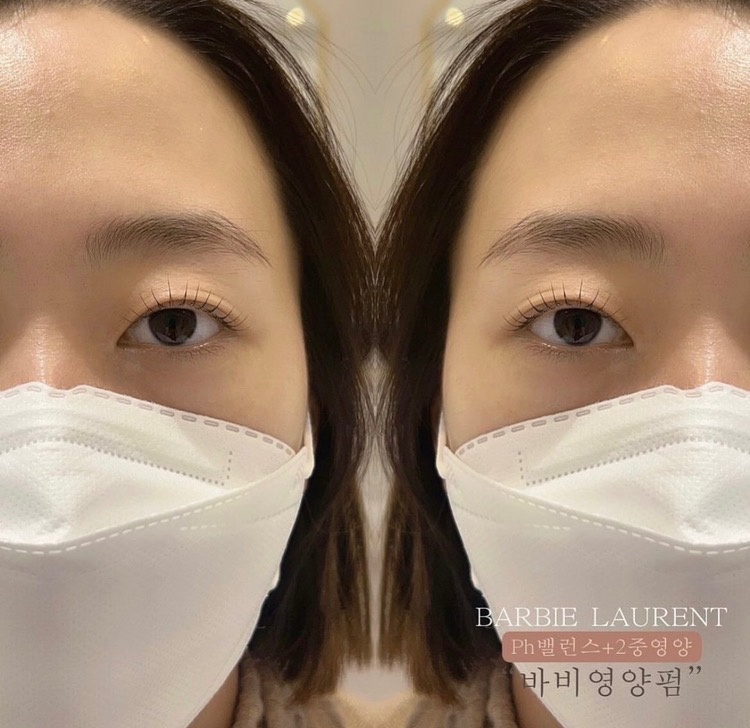 바비로랑 picture 7