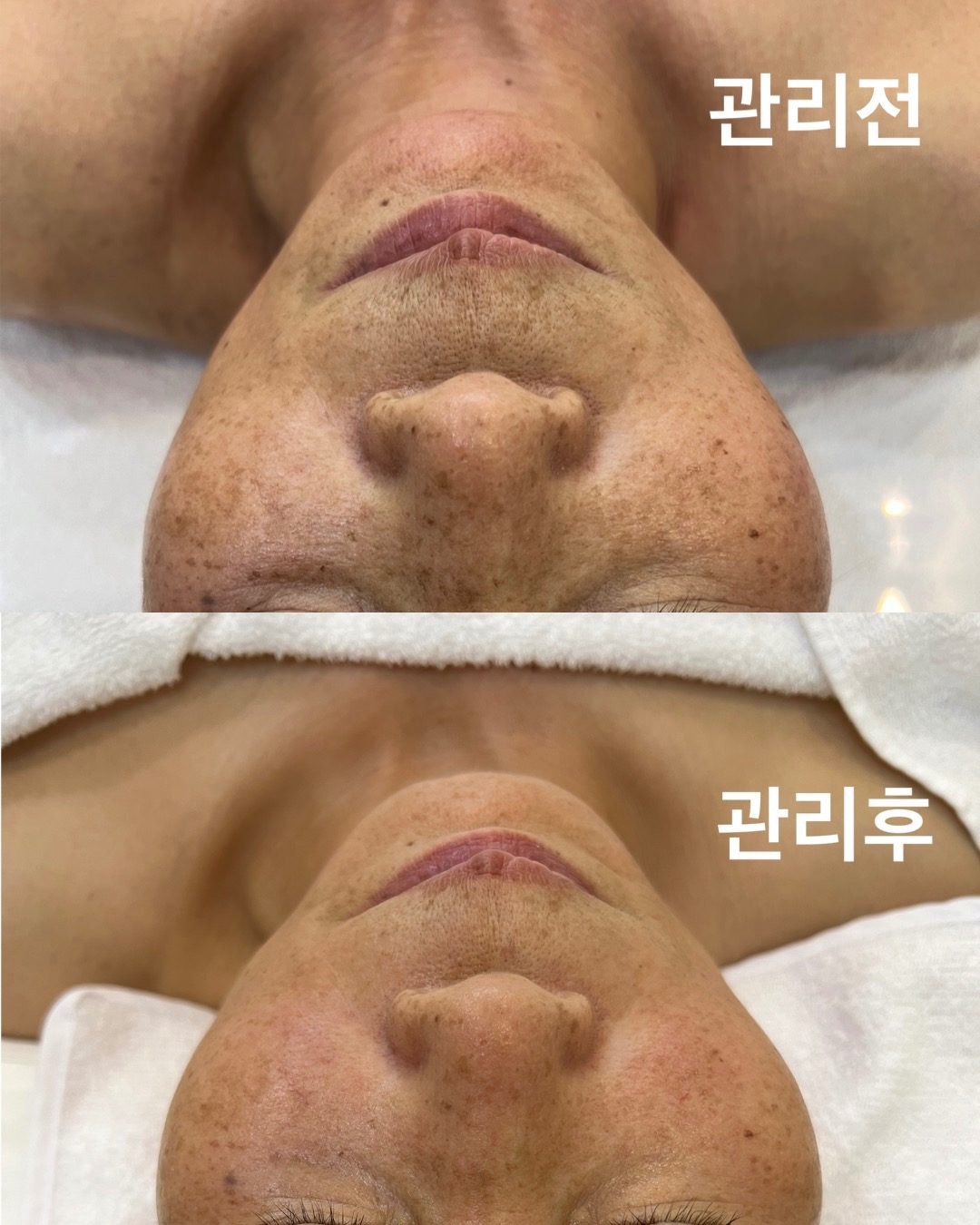 촉촉 수분관리