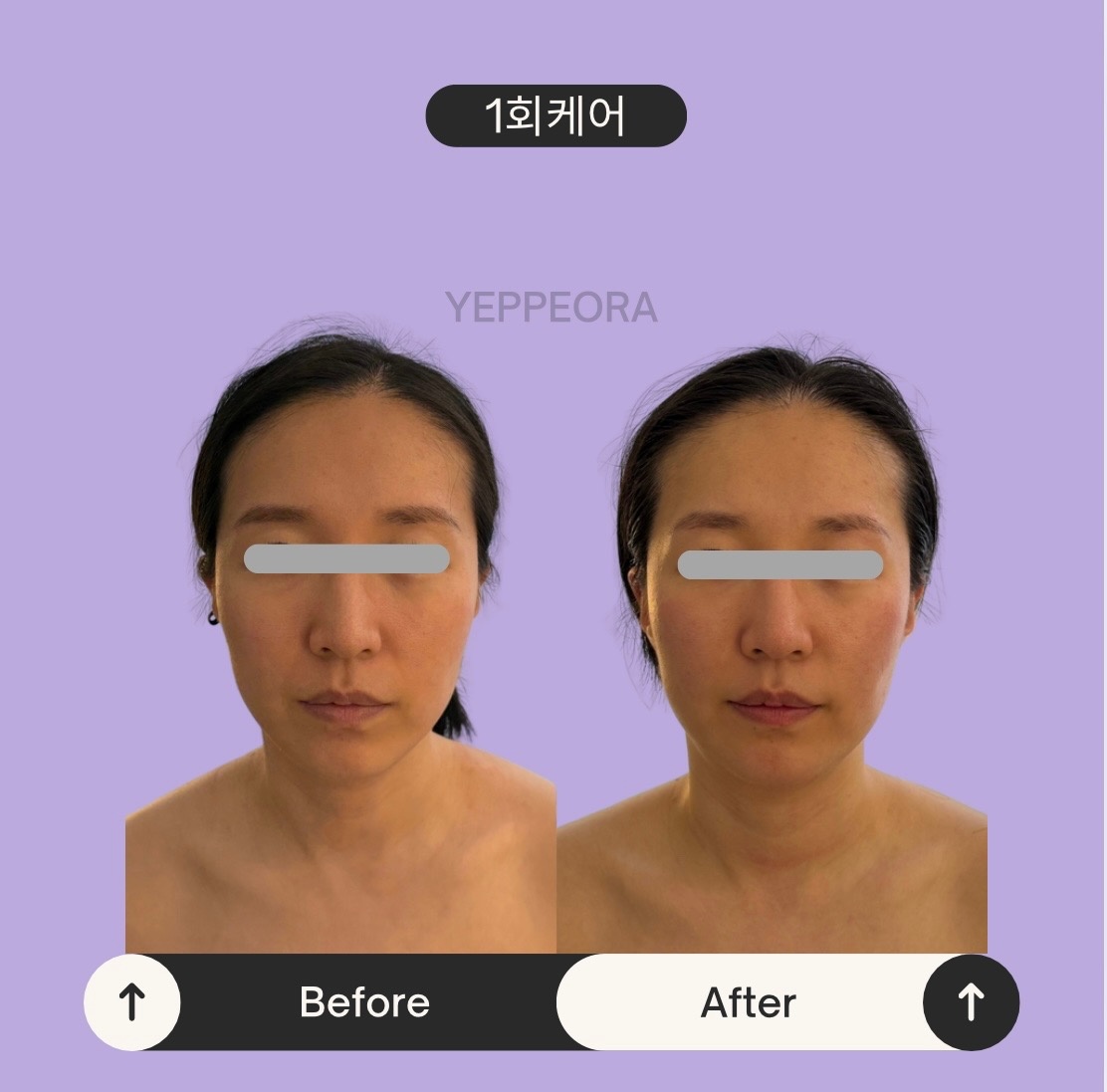 예뻐라 김포본점 picture 8