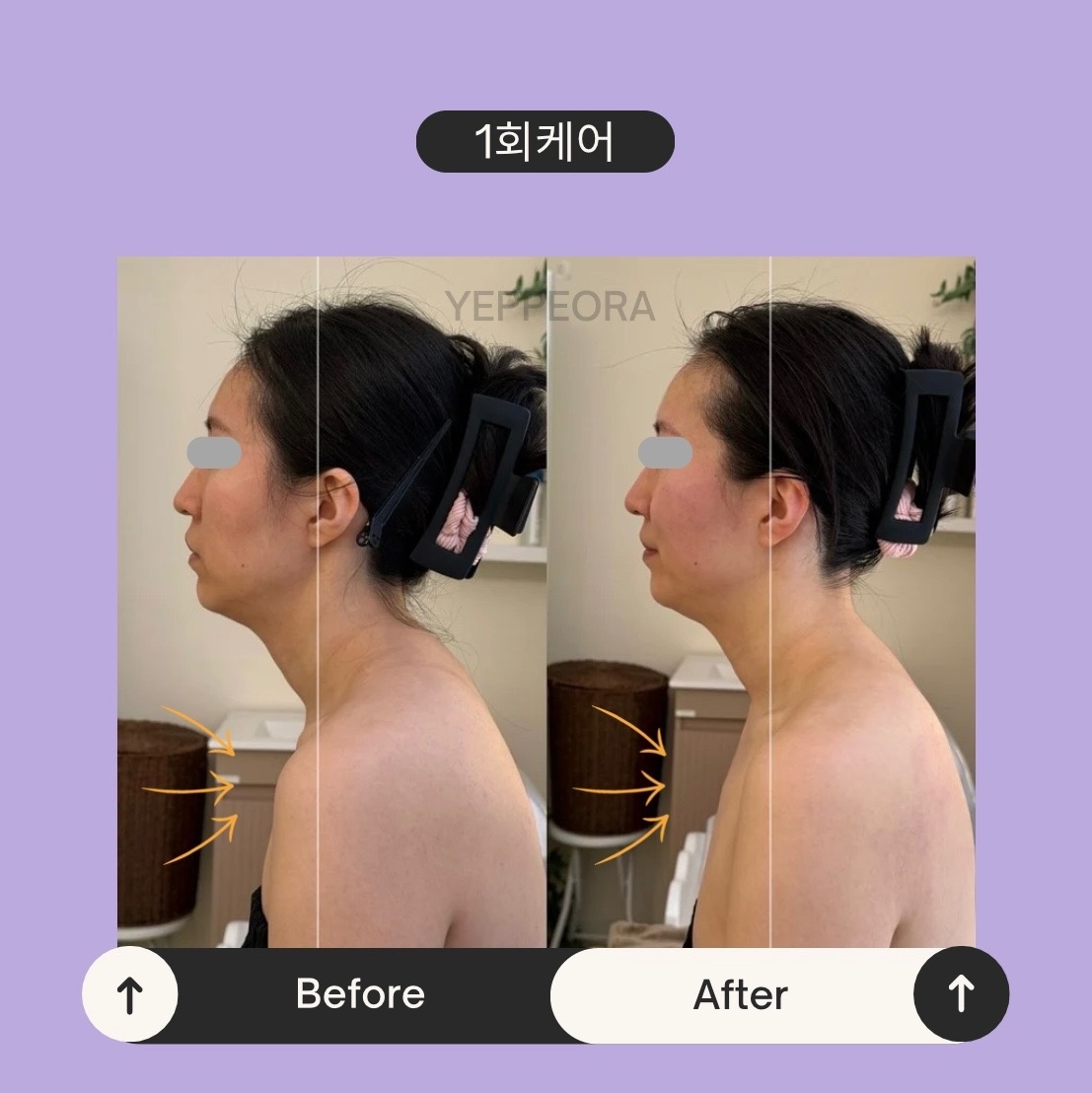 예뻐라 김포본점 picture 9