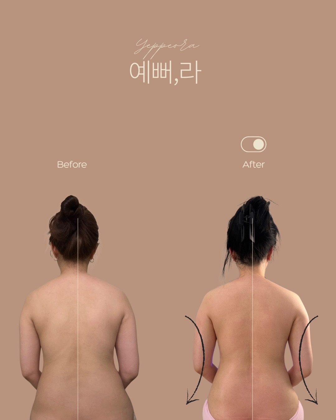 예뻐라 김포본점 picture 7