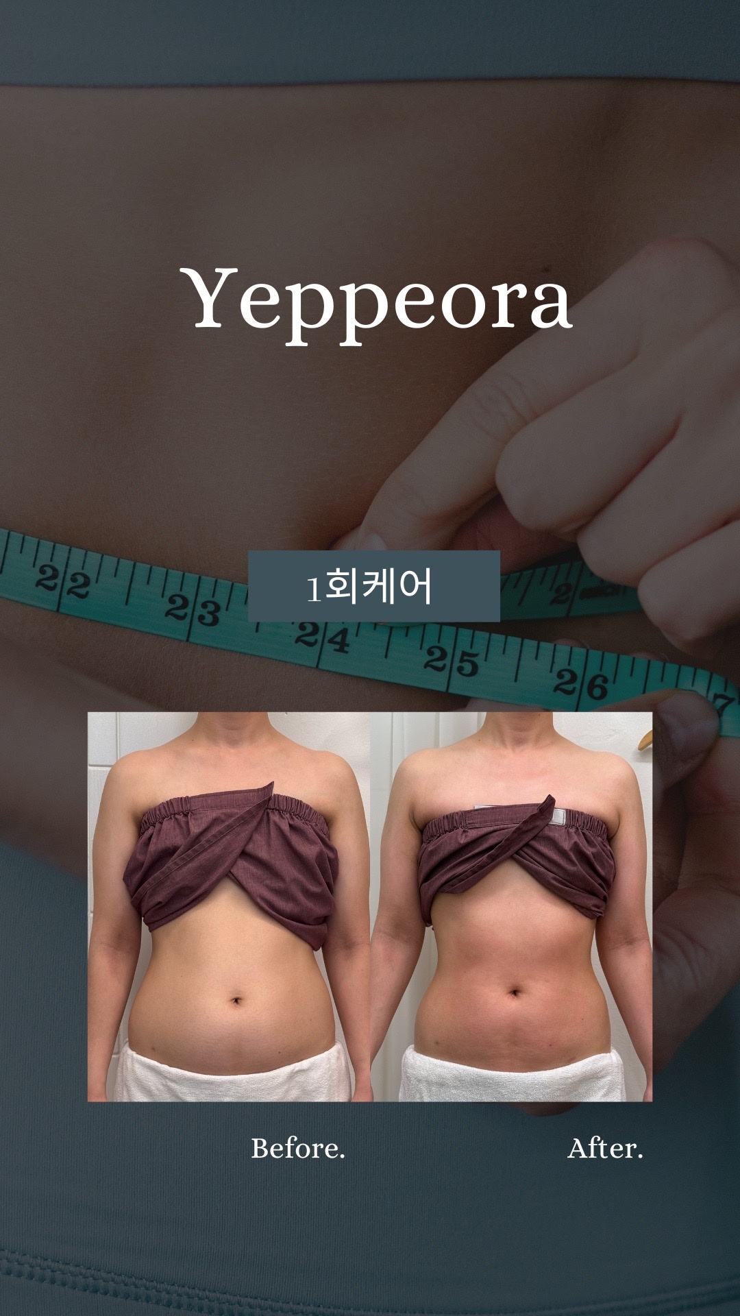 예뻐라 김포본점 picture 6