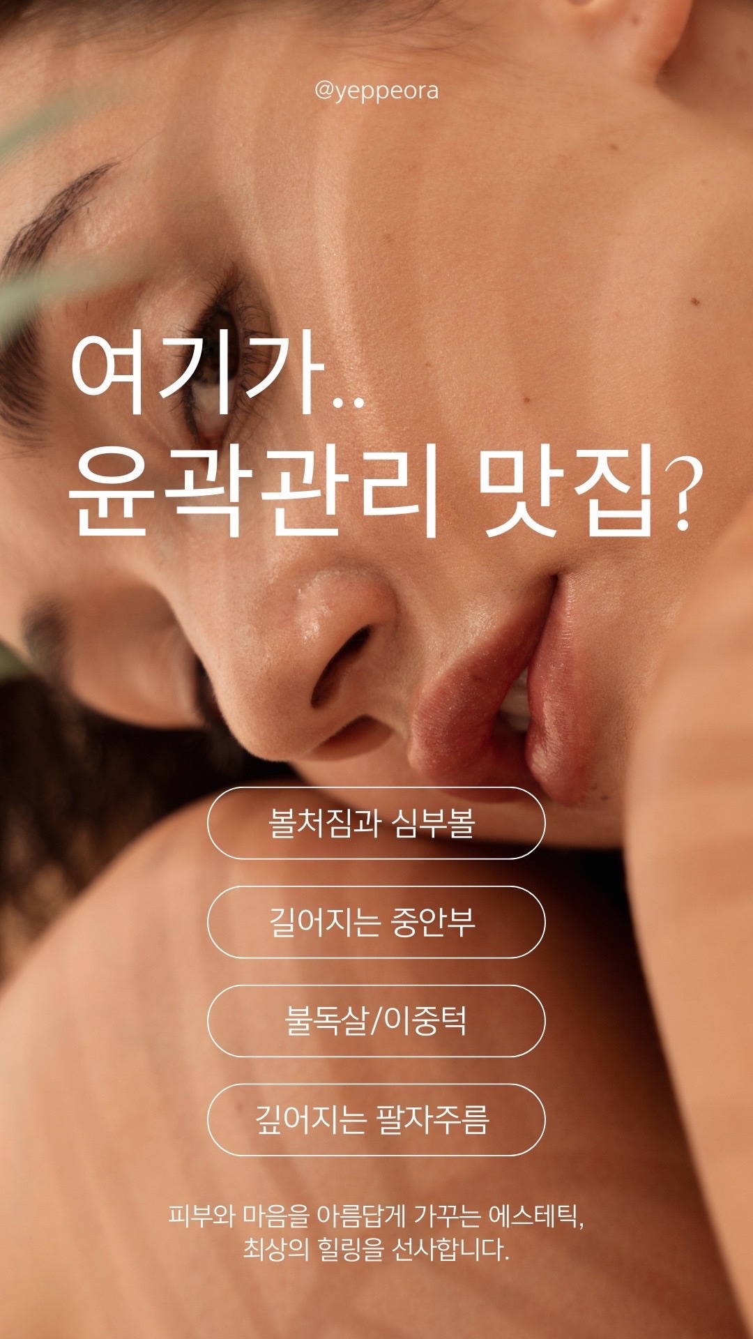 예뻐라 김포본점 picture 2