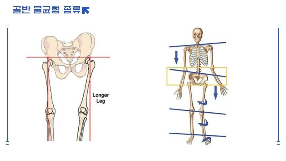 무릎 아프고 다리저림 원인?