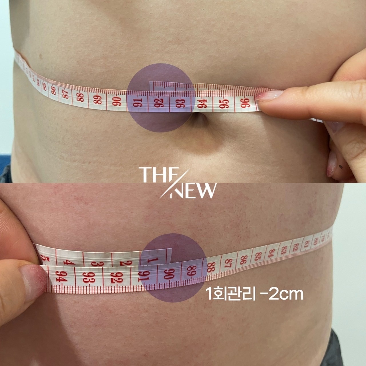 쓰리핏 바디.윤곽.두피 picture 8