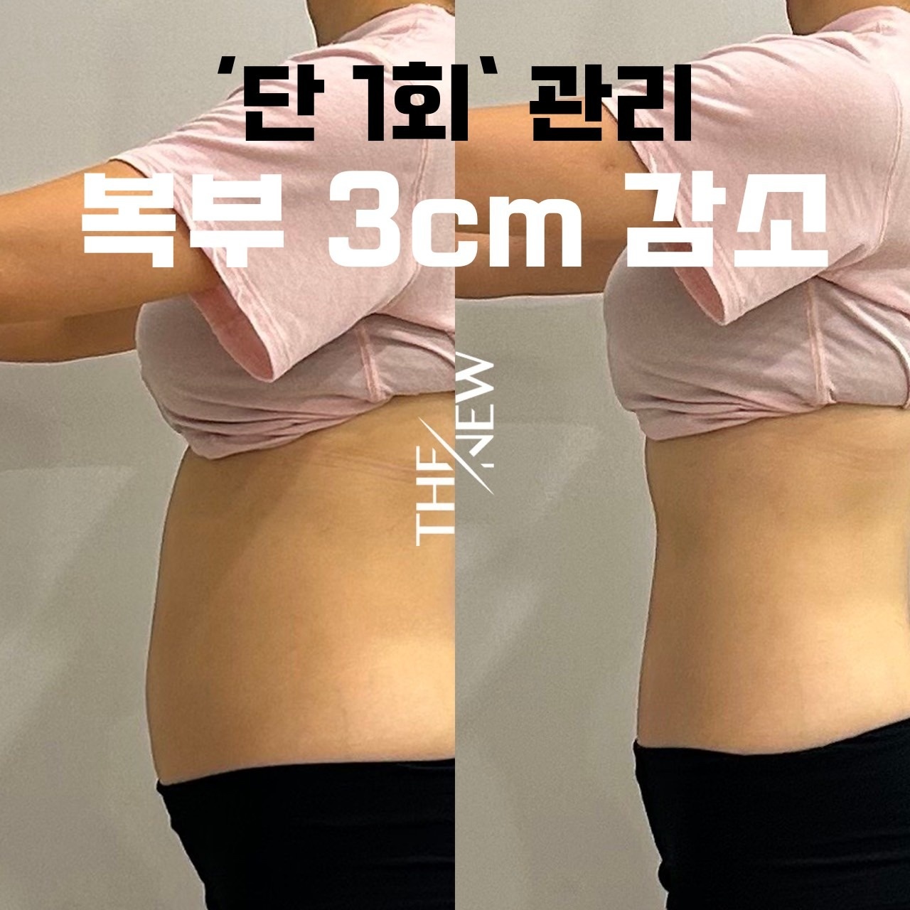 쓰리핏 바디.윤곽.두피 picture 0