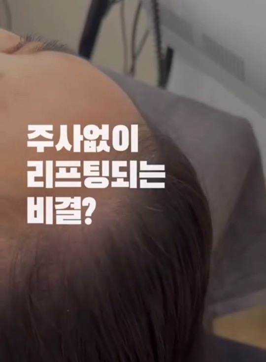 쓰리핏 바디.윤곽.두피 picture 1