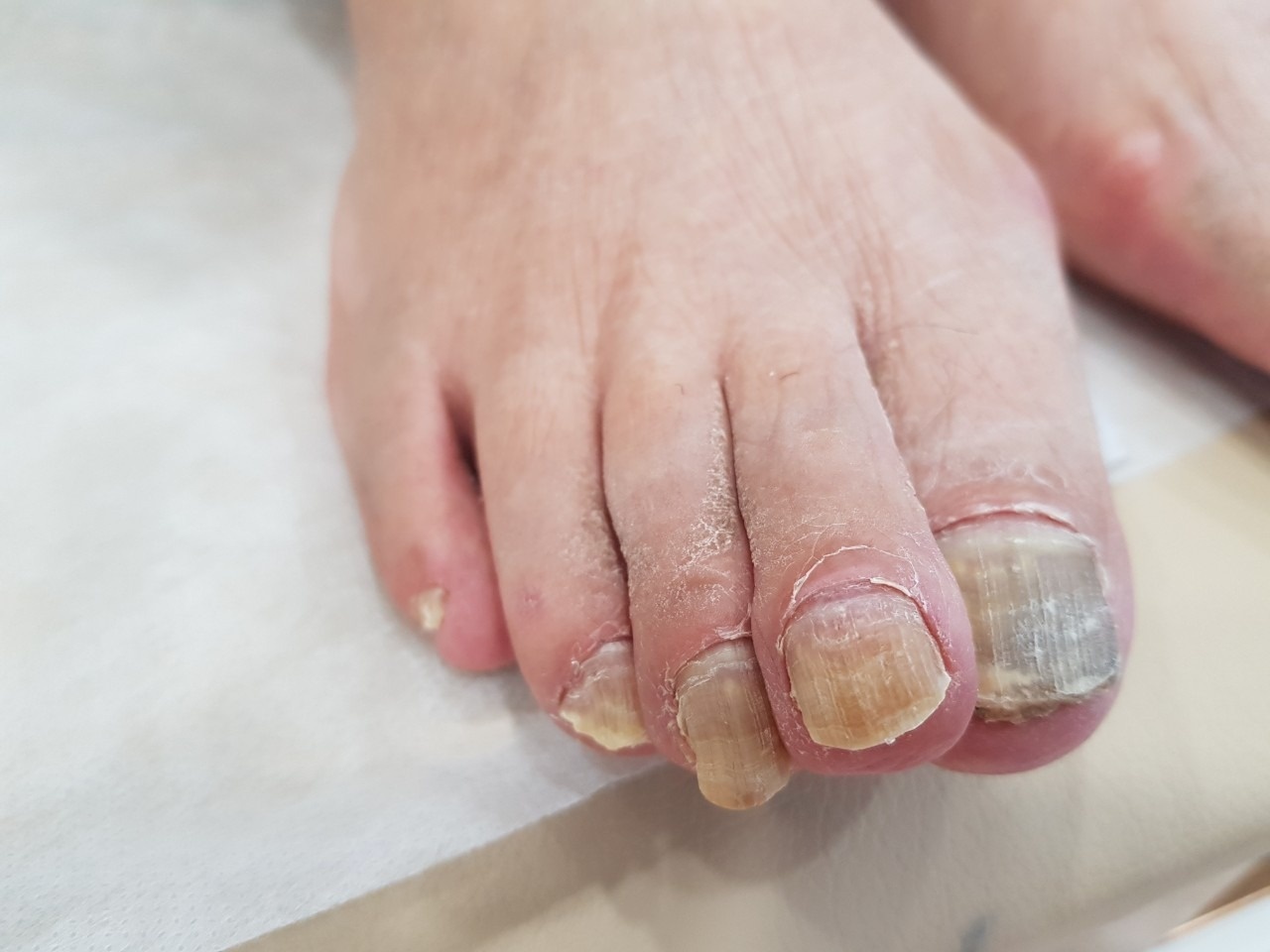 문제성발관리센터 수여성병원 picture 6