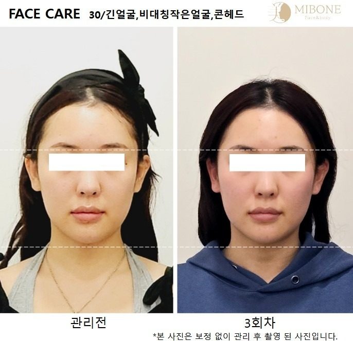 ❤️미본 관리전과 3회차 비포에프터입니다.❤️