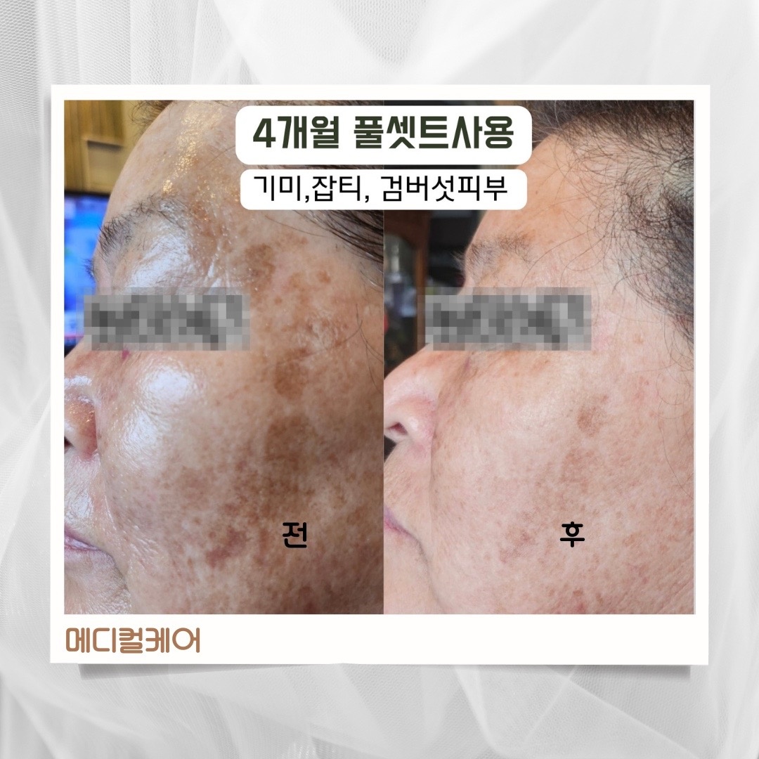 리뷰티 picture 3