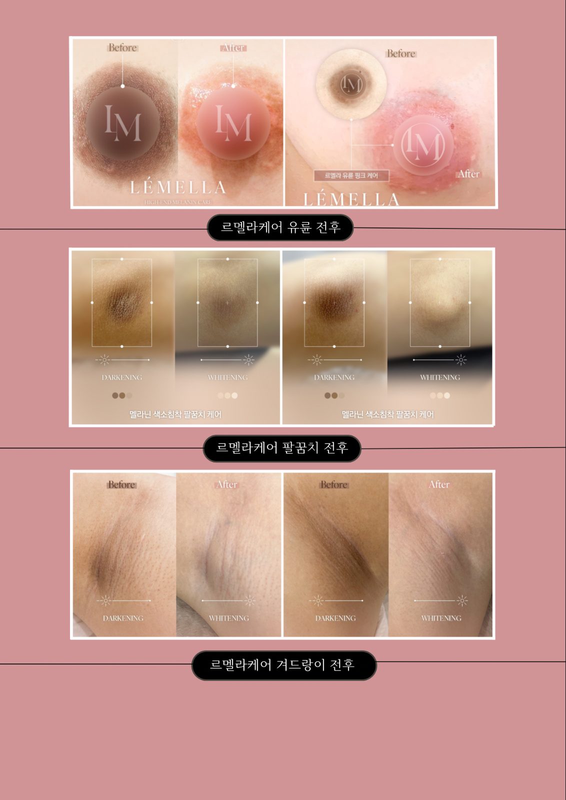 🔥 색소침착케어 20%할인 이벤트 🔥