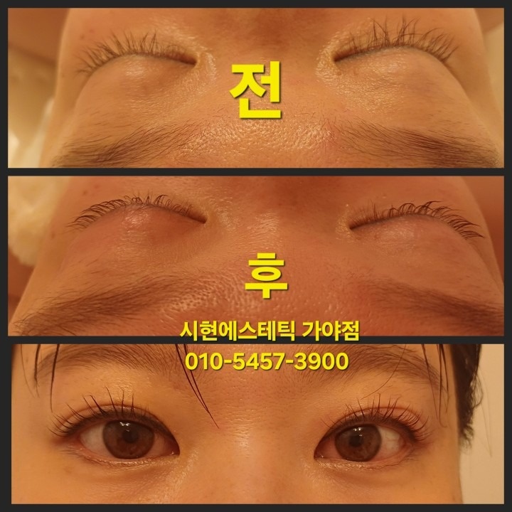 시현에스테틱 가야점 picture 6