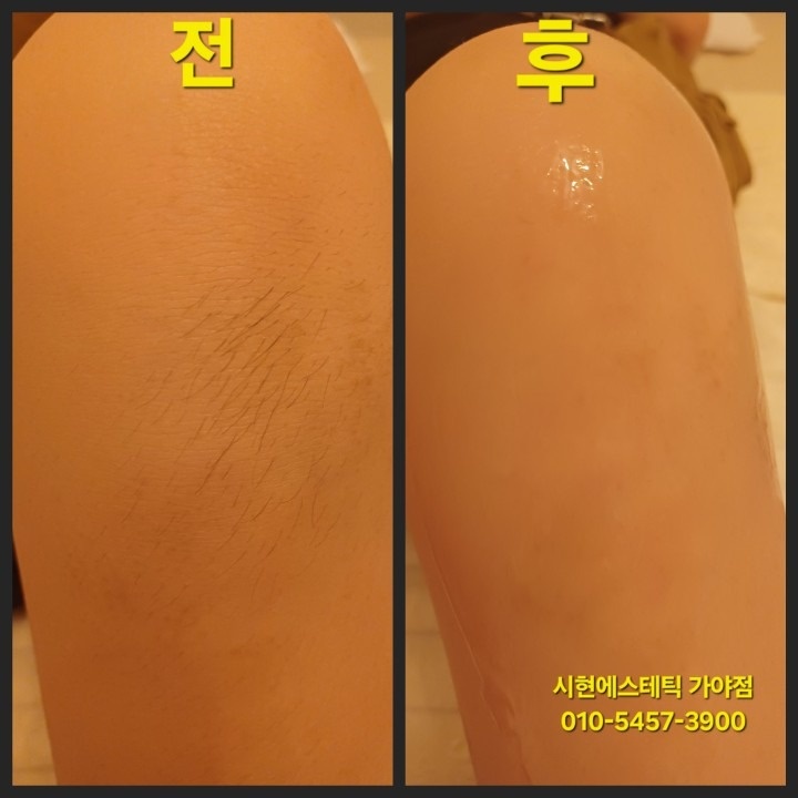 시현에스테틱 가야점 picture 3