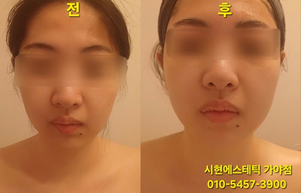 시현에스테틱 가야점 picture 2