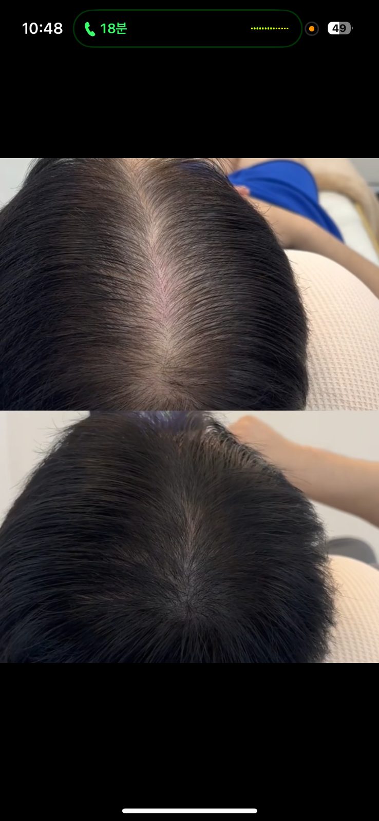머리숱 고민 이제 그만! 신규오픈 기념 할인