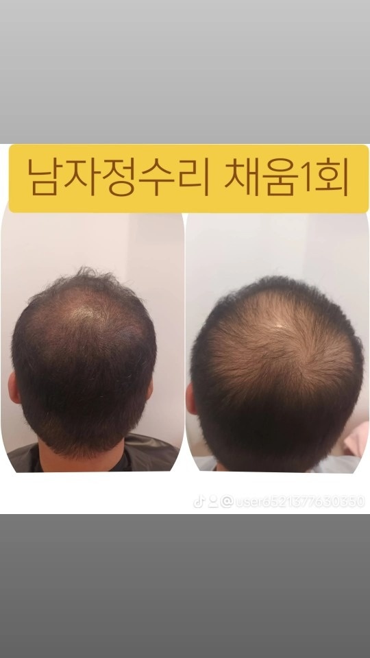 속눈썹눈썹민낯뷰티 picture 5