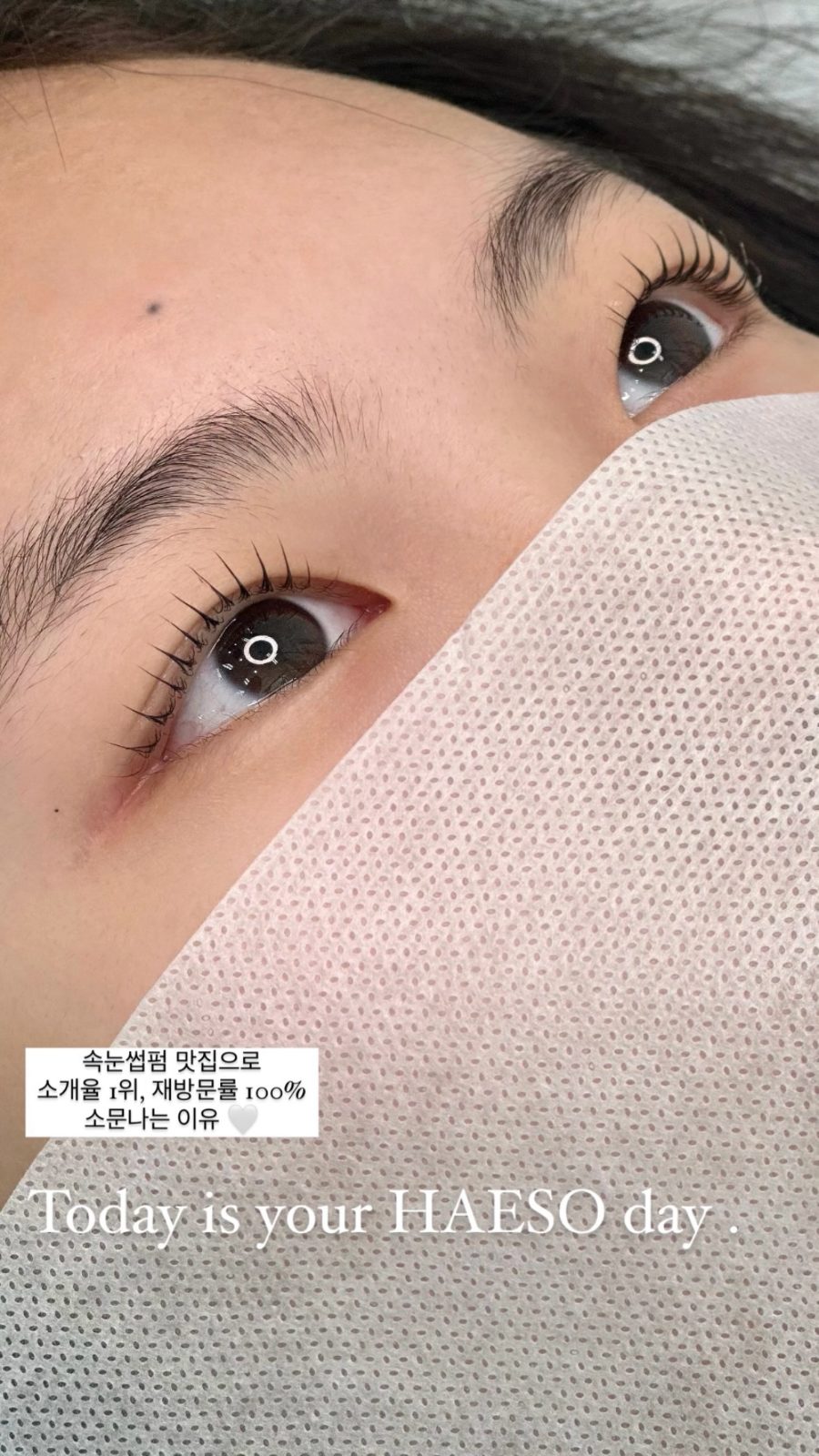 원주 반곡관설동 혁신도시 속눈썹 노글루펌 : 해소