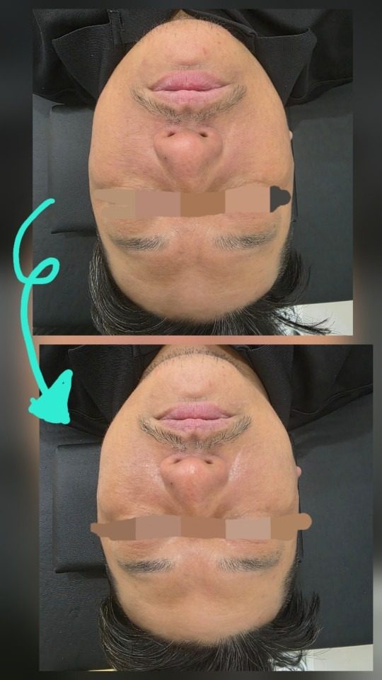 남자도 관리하는 피부
