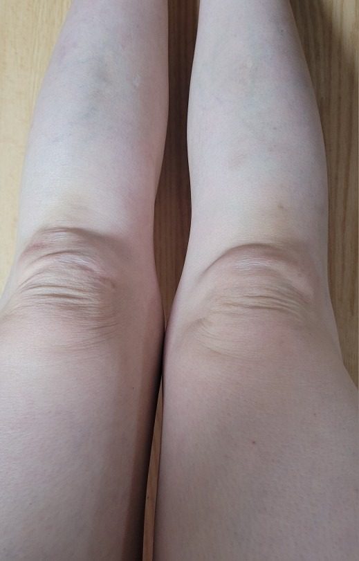 저렴하게 피부도 몸도 어려지실분~