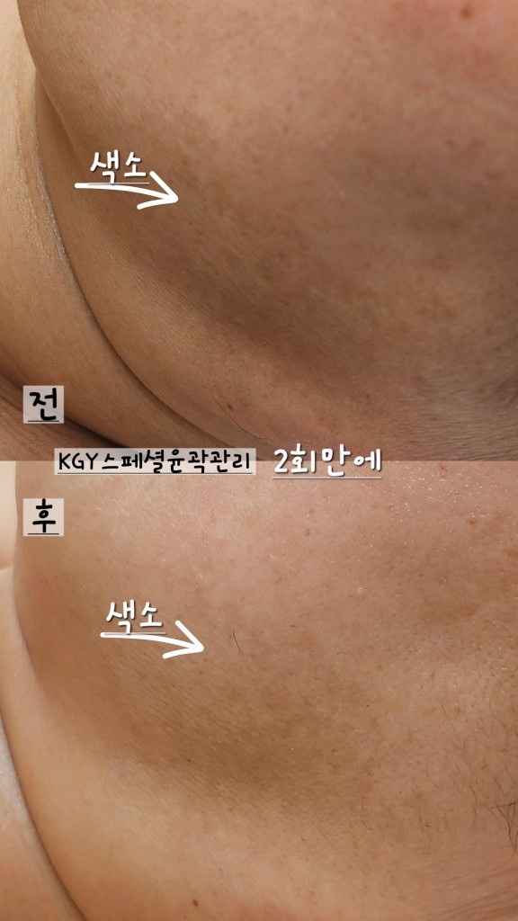 랄라뷰티 플라즈마 picture 6