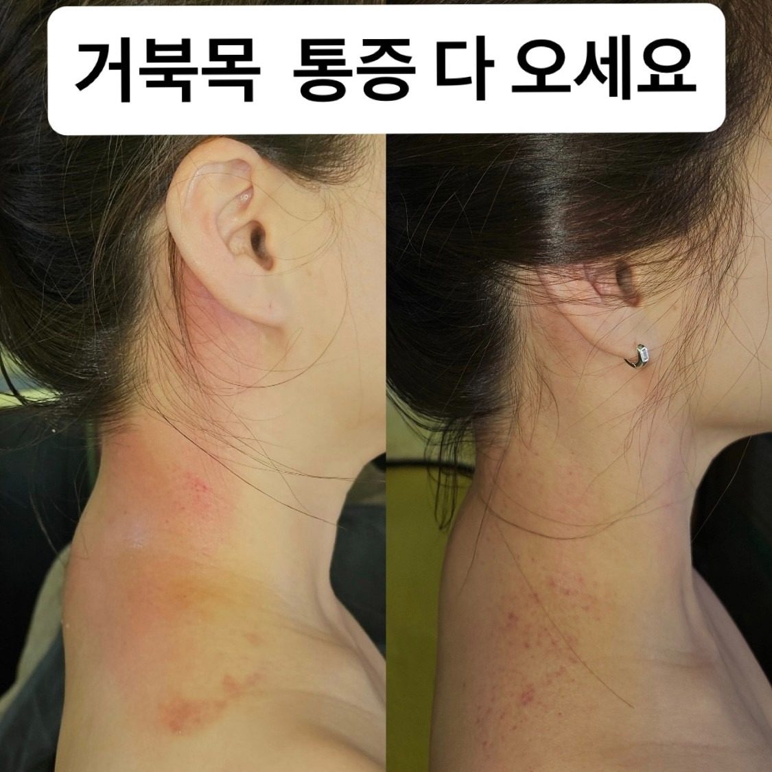 1회  체험   2만원