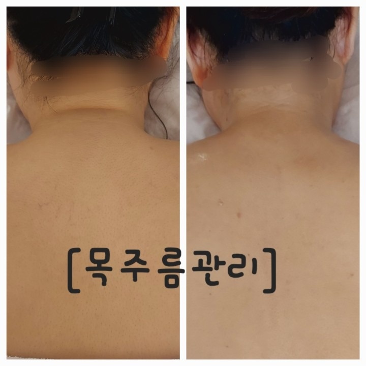 아름더 에스테틱 picture 5