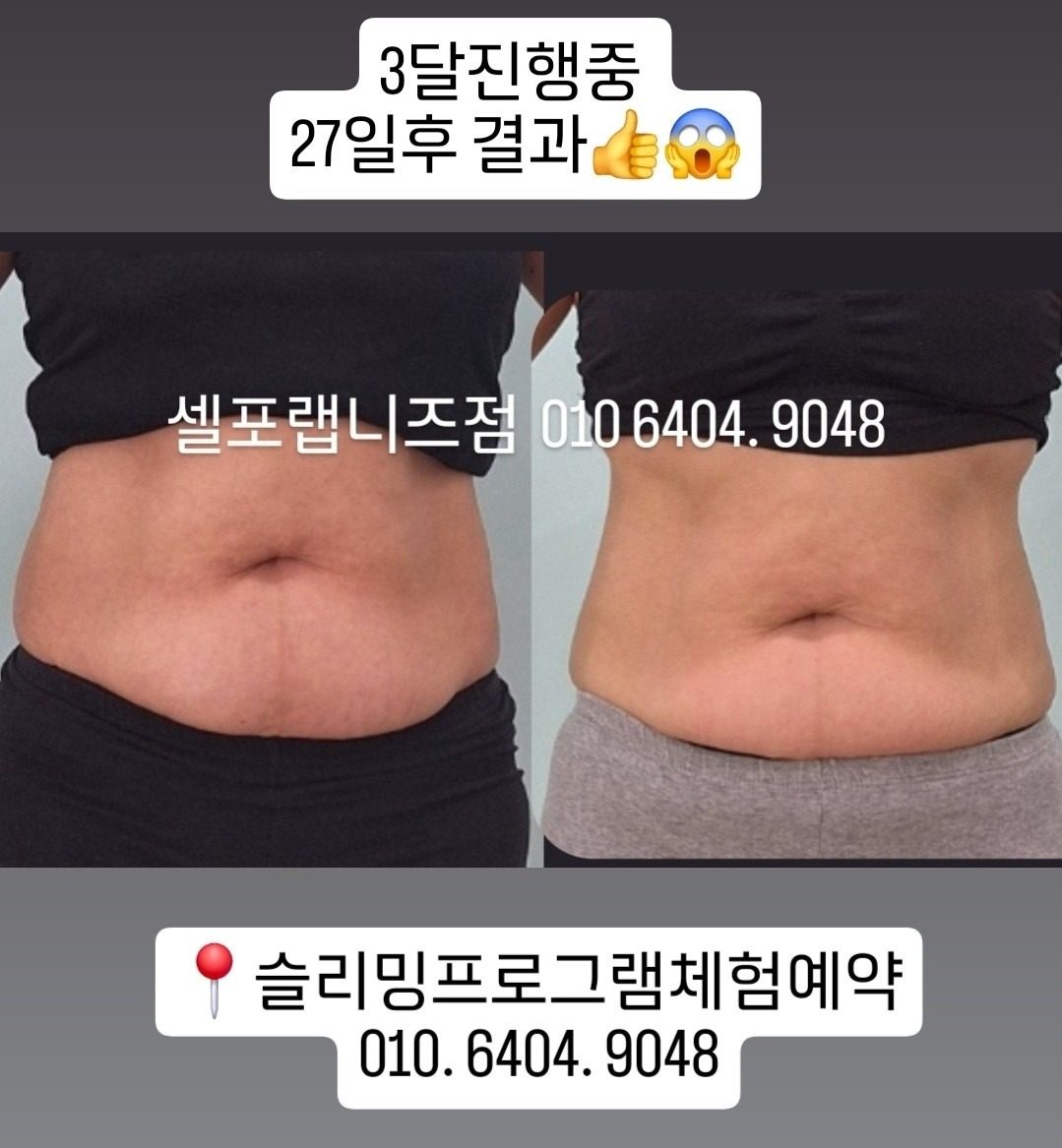 27일관리후 임상 눈바디가 달라졌어요~~