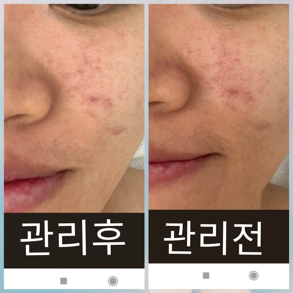 여름철 1회체험이벤트!