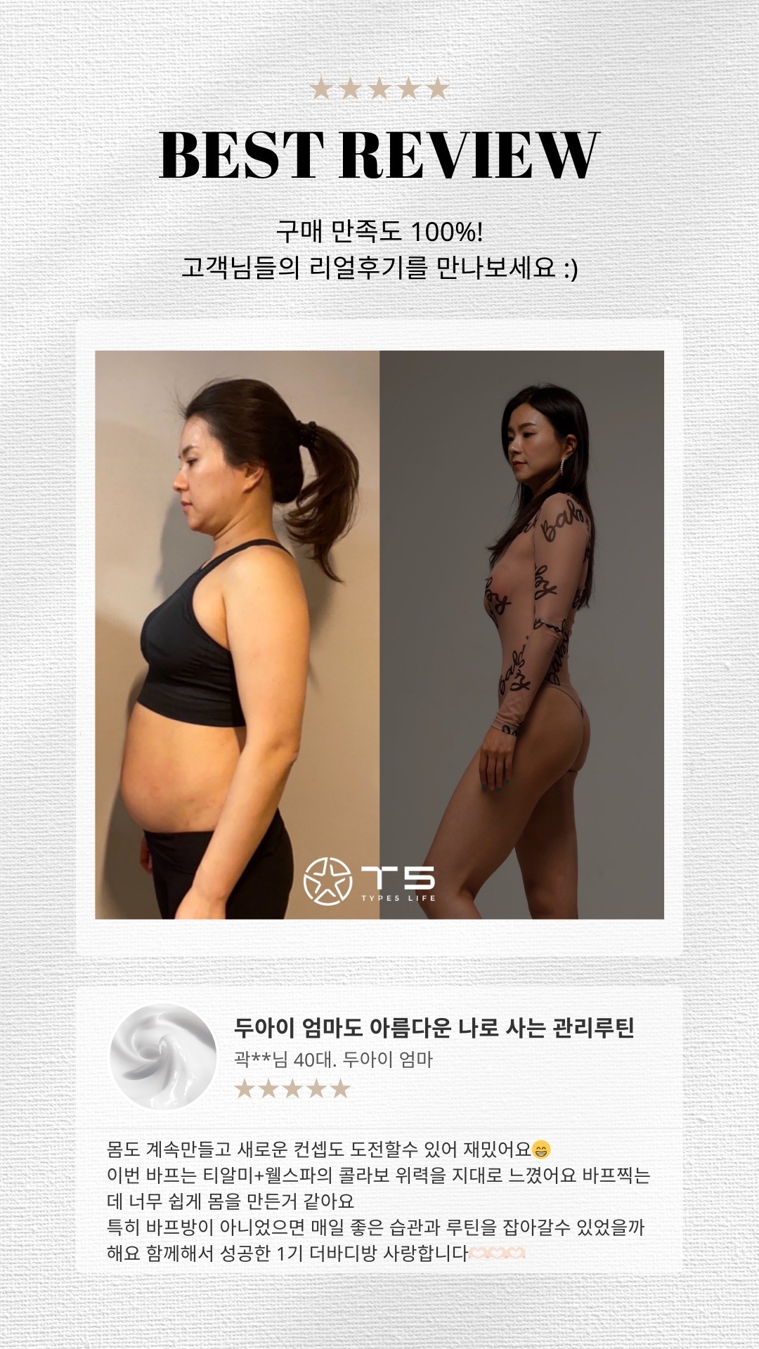 스킨바 매탄점 picture 7