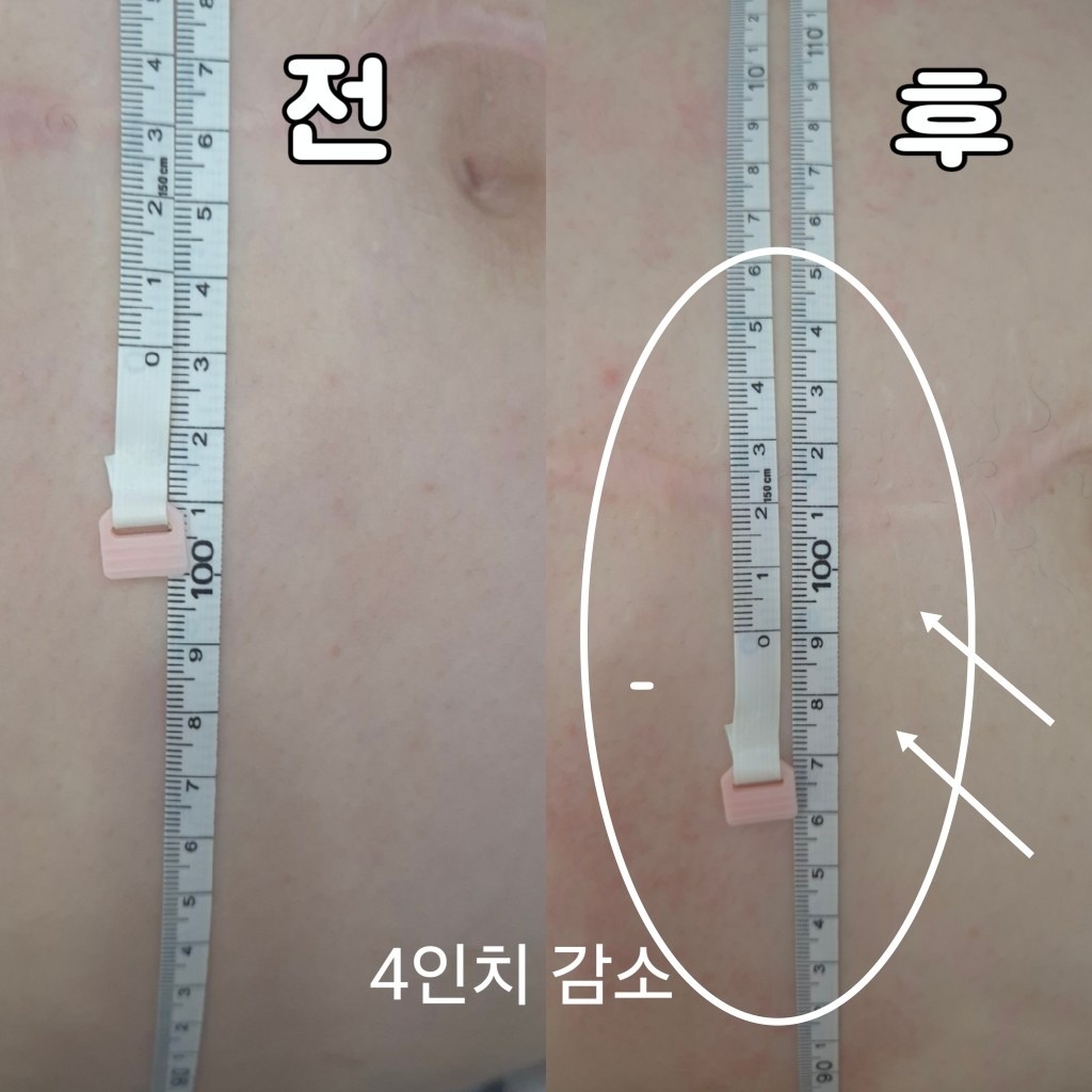 피부개선전문&소개로 마감되는 은선뷰티 picture 4