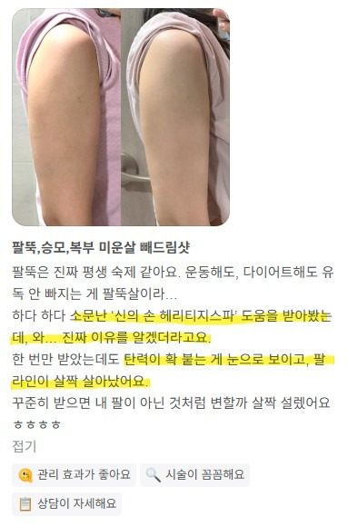 팔뚝살 고민? 빼드림으로 해결!!