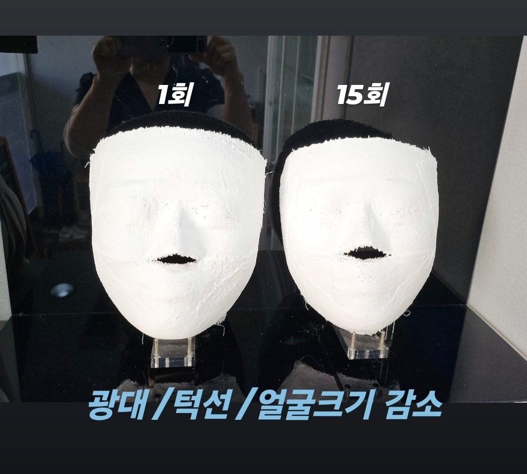🔸️두상과 윤곽관리로🔸️ 동글동글 작은얼굴 